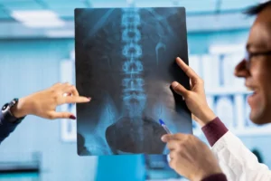 Spinal Fusion After a New York Trucking Accident